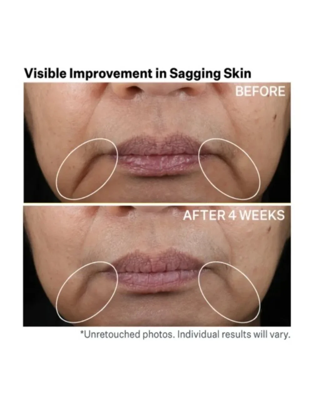 StriVectin contour restore